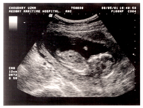 From Humble Beginnings....